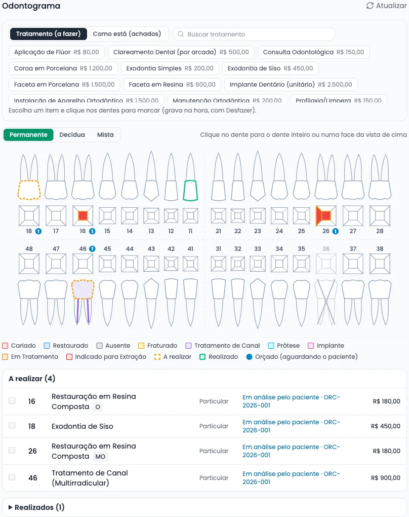 Odontograma de uma paciente fictícia: cárie nos dentes 16 e 26, dente 36 ausente, canal no 46 e a lista do que falta fazer ligada ao orçamento